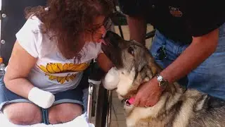 Woman Who Lost Limbs After Dog Lick Still Loves Her