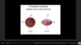 Classification of astigamatism : with the rule, against the rule and oblique axis(emmetrope part 4)