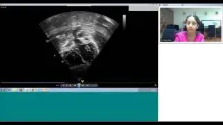 Pedicardio Classes on Basic echo views by Dr Sejal Shah