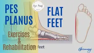 Pes Planus & Flat Feet & Exercises & Rehabilitation (@fiziomasaj)