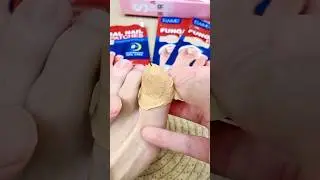These Fungal Nail Patches Actually WORK! 🤯