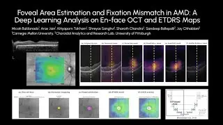 Foveal Area Estimation and Fixation Mismatch in AMD: A Deep Learning Analysis