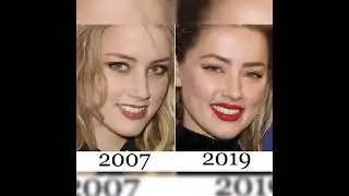 Amber Heard plastic surgery.