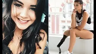 Jess Quinn who lost her leg to bone cancer talks struggles