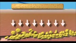 Les soins corporels M&eacute;thode Laurand - Part 2 : Electrostimulation
