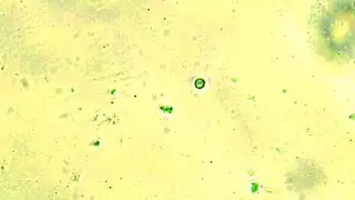 BIS4083: PROTOZOOLOGY - AMOEBA