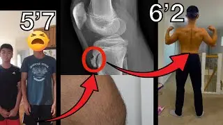 СЕКРЕТ СКАЧКА РОСТА НА 7 ДЮЙМОВ! *СМОТРИ, ПОКА НЕ ПОЗДНО*