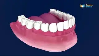 Get Partial Dentures or Full Set Dentures Now! Contact Now