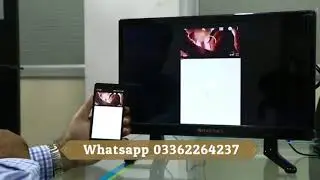 Wireless Dongle or miracast for TV | Connect Mobile With TV | Shopznowpk.com