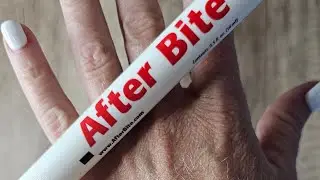 After Bite Mosquito, Flea and Tick Itch Eraser Pen