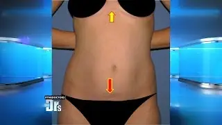 How Plastic Surgeons Hide Scars