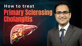 Primar sclerosing cholangitis Treatment, Symptoms, Pathology, Diagnosis Medicine lecture USMLE