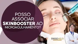 Posso associar Skinbooster ao Microagulhamento?