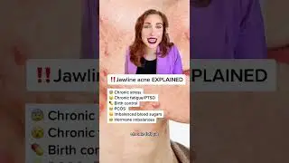 JAWLINE ACNE EXPLAINED!
