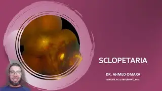 21 Wills eye manual - Sclopetaria (Arabic Narration)