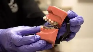 What is a Herbst Appliance & How Do The Parts All Work Together in Your Mouth? Cook Ortho of Dublin