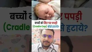 बच्चो के सिर पर पपड़ी (cradle cap) कैसे हटाये