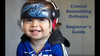 Cranial Remolding Orthosis (Helmet) Beginner's Guide