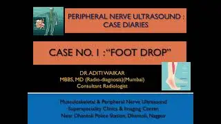 Peripheral Nerve Ultrasound Diaries : Case no. 1 : Foot Drop