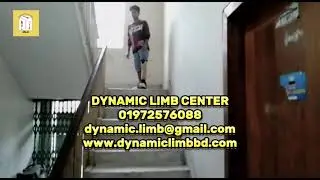 Revolutionizing Lives with Advanced Artificial Limbs | Dynamic Limb Center