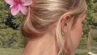 OTOPLASTY/pinned back ears- SUBLIMINAL