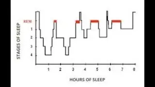 Sleep Doctor Answers the question, 