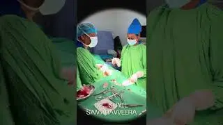 Why Doctors Remove a Testicle (Orchidectomy Explained)