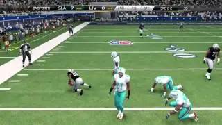 Madden 25 :: XBOX ONE Gameplay :: Amazing TOUGH game - MUT 25 XboxOne