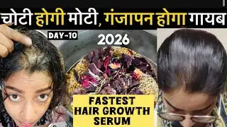 15 Days Hair Growth Challenge👍Day-10 Fastest Hair Growth Serum & Gel#haircare#serum#hairgrowth#viral