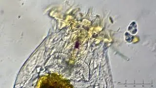 Brachionus urceolaris _s.l.