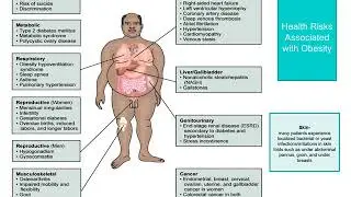 Obesity and Obesity Surgery narrated