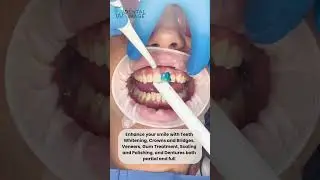 Experience expert dental care at Dental Image #dentalimage #shorts