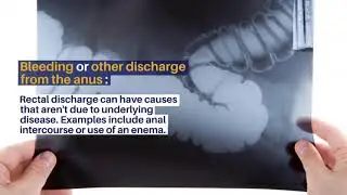 When to see a Proctologist - The Life Plus Hospital