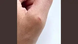 Moving Slow Through Hackney