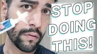 Stop Using Toothpaste On Spots - Acne / Spot Treatments  ✖ James Welsh