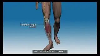How FES lifts the foot