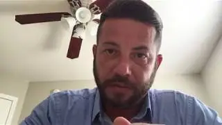 Hair Replacement Men's hair system review what's the cost!!