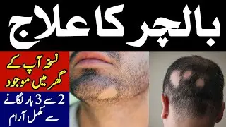 Balchar ka desi ilaj || How to treat Alopecia || Hakeem Zia Shahid