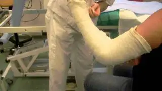 Broken arm takine of gypsum