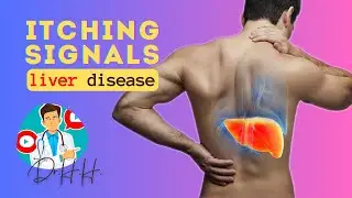 ITCHING can indicate LIVER DISEASES!
