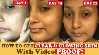 How to Get Clear & Glowing Skin | 21 Days Face Transformation