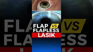 Flap V/S Flapless Lasik
