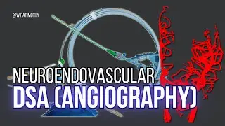 Brain Angiography (DSA) - Theory & Practice