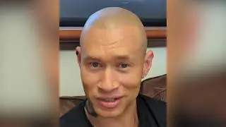 Is Scalp Micropigmentation Painful? & Other Common Questions about SMP