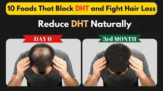 Top 10 Foods That Block DHT and Fight Hair Loss | How Can I Reduce DHT Naturally?