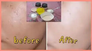 How to get Glowing skin instantly at home by Be Glam #glowingskin #athome #remedy #BeGlam