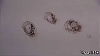 Euplotes Under the Microscope
