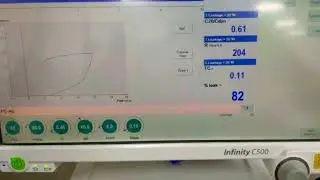 How to recognise Air leak in pressure- volume loops? mechanical ventilation