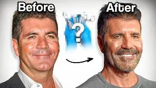 How Botox Ruins Your Face...