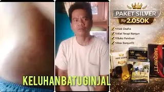 Keluhan Batu Ginjal 